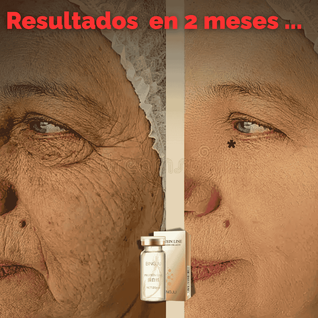 HILOS DE PROTEÍNA DE COLÁGENO 2x1 - CADA SET CONTIENE 20 HILOS