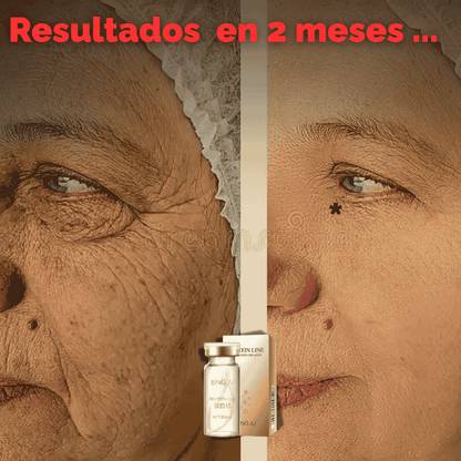 HILOS DE PROTEÍNA DE COLÁGENO 2x1 - CADA SET CONTIENE 20 HILOS